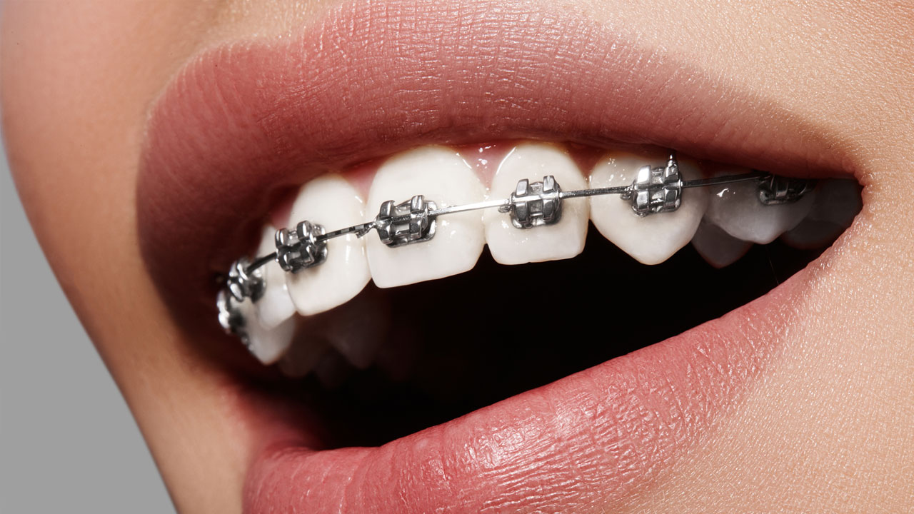 Orthodontist Lake Zurich