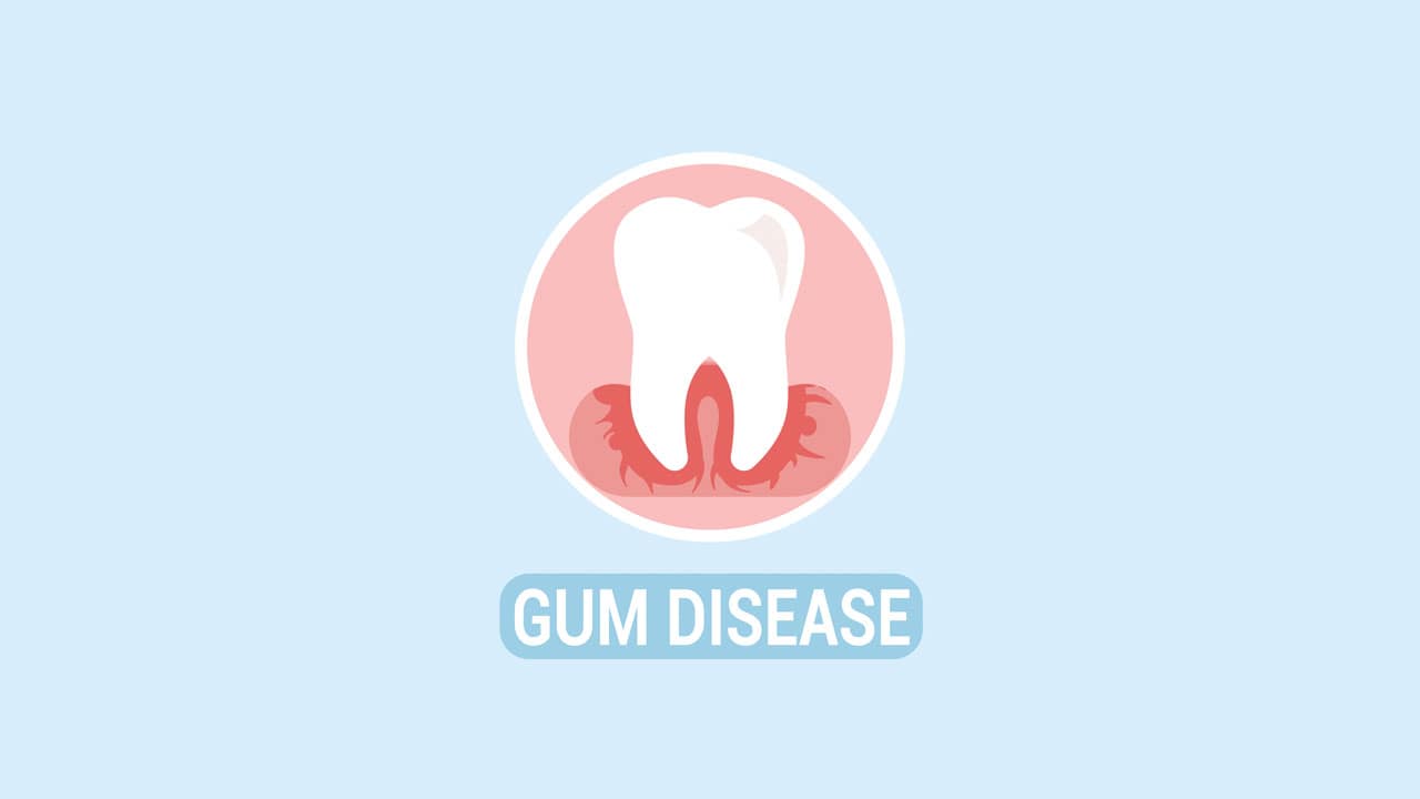 Gum disease